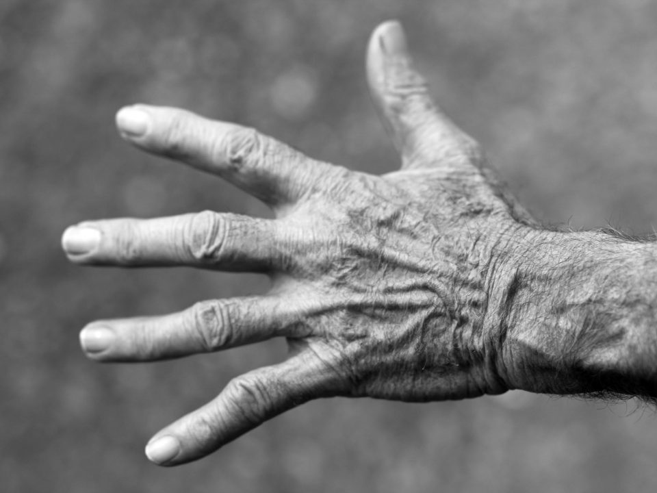 trattamenti riabilitativi artrite